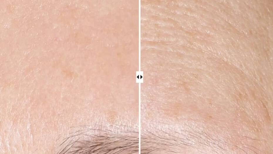 AlphaRet Overnight Cream 30 mL