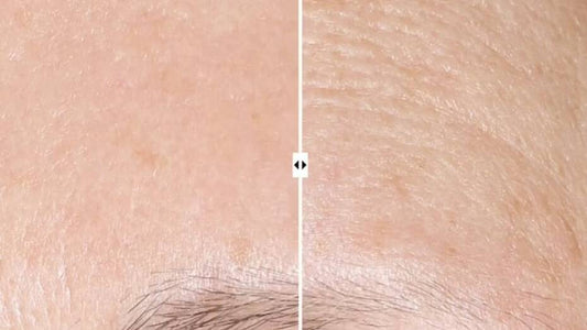 AlphaRet Overnight Cream 30 mL